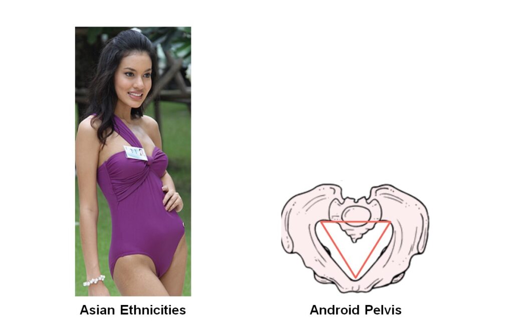 Ethnic Pelvic Shapes